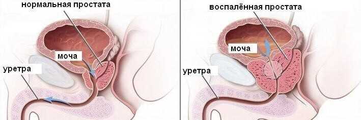 Рефлексная реакция организма