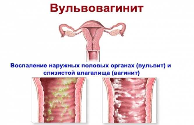 Какое значение имеет опухание половых губ после полового акта?