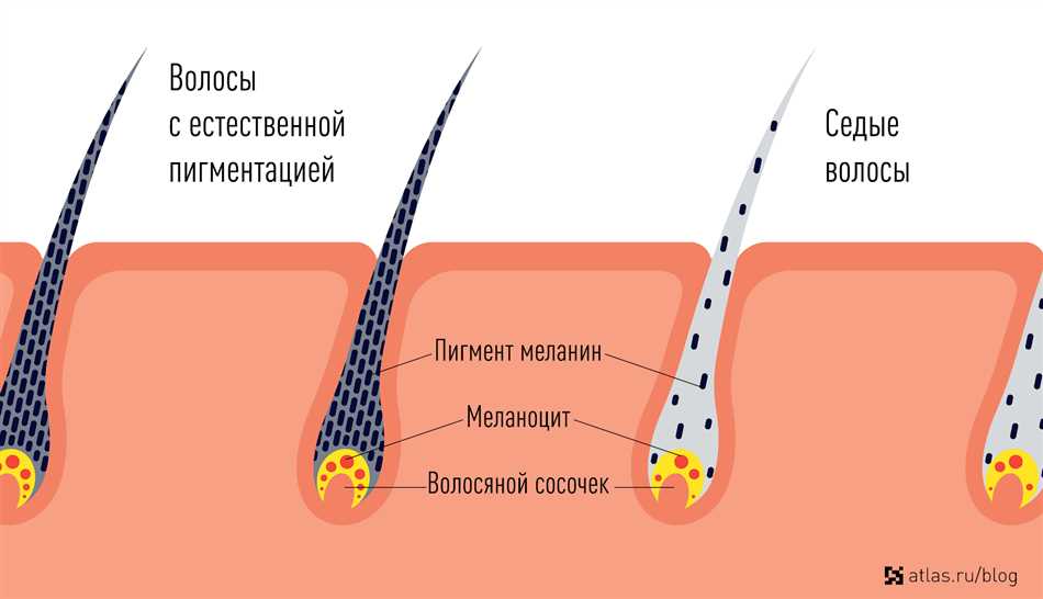 Аутоиммунные заболевания