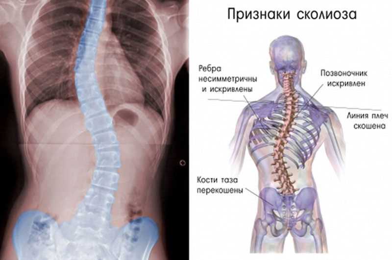 Почему разные ребра