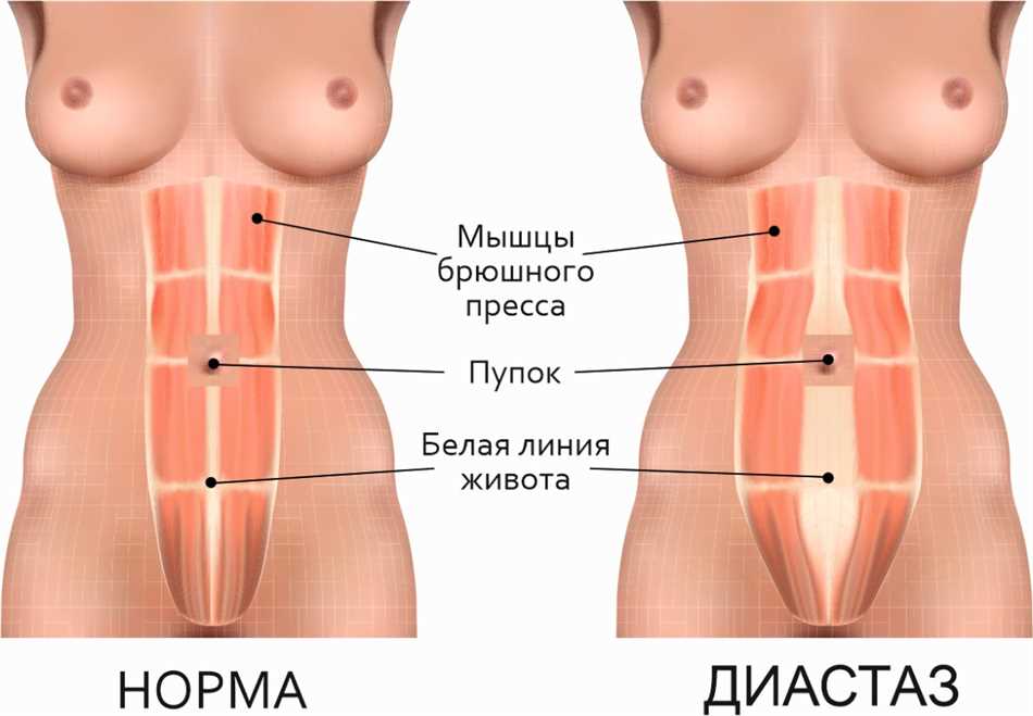 Физиология мышц пресса