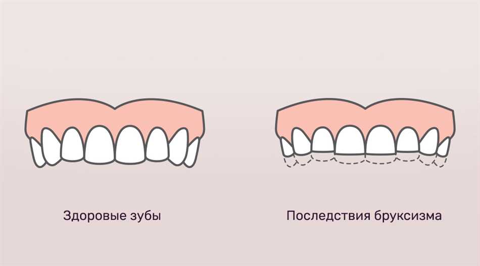С какой силой сжимается челюсть человека
